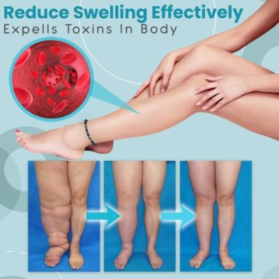 Anti Varicose,Swelling Magnetotherapy Anklet,Magnetotherapy Anklet,Swelling Magnetotherapy