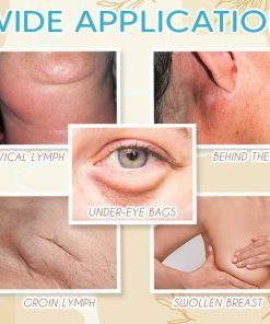 Lymphedem Detoxification Cream,Detoxification Cream,Lymphedem Detoxification