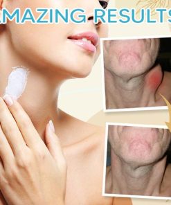 Lymphedem Detoxification Cream,Detoxification Cream,Lymphedem Detoxification