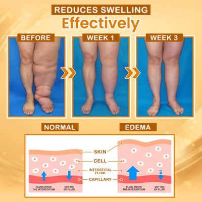 Anti Swelling Natural Rolling Ball Slimming Serum,Anti Swelling,Natural Rolling Ball,Slimming Serum,Rolling Ball