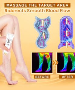 Anti Swelling Natural Rolling Ball Slimming Serum,Anti Swelling,Natural Rolling Ball,Slimming Serum,Rolling Ball