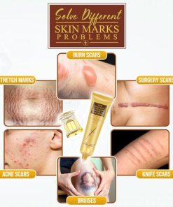 Body Mark Repair Treatment Gel,Repair Treatment Gel,Treatment Gel,Body Mark