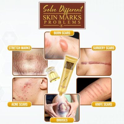 Body Mark Repair Treatment Gel,Repair Treatment Gel,Treatment Gel,Body Mark