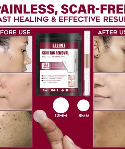 Spots Removal Treatment Patches Set,Spots Removal Treatment Patches,Spots Removal,Treatment Patches Set,Treatment Patches