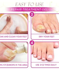 Ginger Health Toe Repair Treatment Gel,Health Toe Repair Treatment Gel,Toe Repair Treatment Gel,Repair Treatment Gel,Treatment Gel