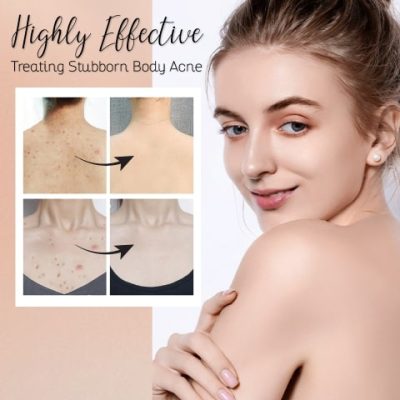 Acne Treatment Body Spray,Acne Treatment,Body Spray,Treatment Body Spray,Acne Treatment Body