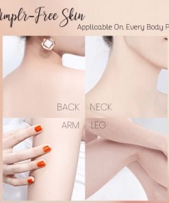 Acne Treatment Body Spray,Acne Treatment,Body Spray,Treatment Body Spray,Acne Treatment Body