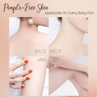 Acne Treatment Body Spray,Acne Treatment,Body Spray,Treatment Body Spray,Acne Treatment Body