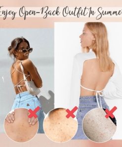 Acne Treatment Body Spray,Acne Treatment,Body Spray,Treatment Body Spray,Acne Treatment Body