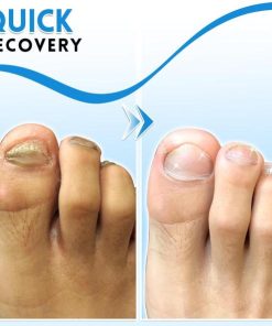 Anti-Fungus Repairing Pen,Fungus Repairing Pen,Repairing Pen,Fungus Repairing,Anti-Fungus