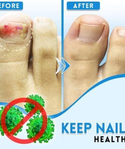 Anti-Fungus Repairing Pen,Fungus Repairing Pen,Repairing Pen,Fungus Repairing,Anti-Fungus