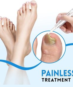 Anti-Fungus Repairing Pen,Fungus Repairing Pen,Repairing Pen,Fungus Repairing,Anti-Fungus