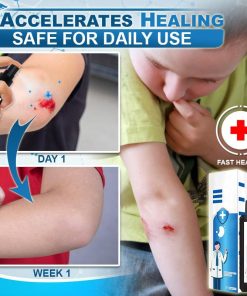 Instant Cure Consolidant Spray,Cure Consolidant Spray,Consolidant Spray,Instant Cure Consolidant