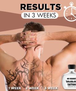 No Regret Tattoo Remove Oil,Tattoo Remove Oil,Tattoo Remove,Remove Oil,No Regret