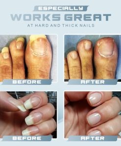 Auto Lock Portable Anti Splash Nail Clipper,Anti Splash Nail Clipper