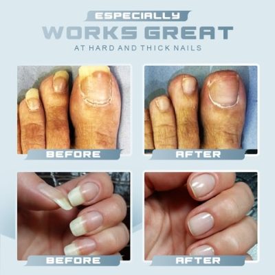 Auto Lock Portable Anti Splash Nail Clipper,Anti Splash Nail Clipper