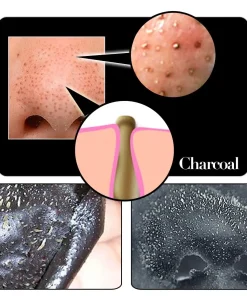 Blackhead Remover,Blackhead Remover Mask