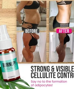 Cellulite Heating Spray,Heating Spray,Cellulite Heating