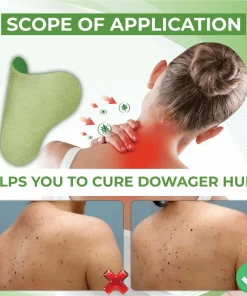 DowagerHump NeckDrain Patch