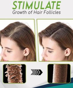 Hair-Growth Essence Spray,HerbalRevive Hair-Growth Essence Spray