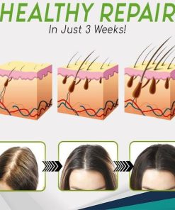 Hair-Growth Essence Spray,HerbalRevive Hair-Growth Essence Spray