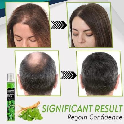 Hair-Growth Essence Spray,HerbalRevive Hair-Growth Essence Spray