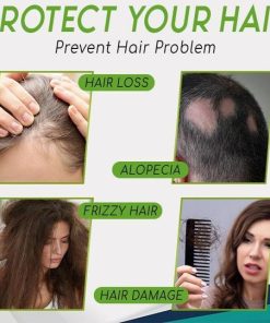 Hair-Growth Essence Spray,HerbalRevive Hair-Growth Essence Spray