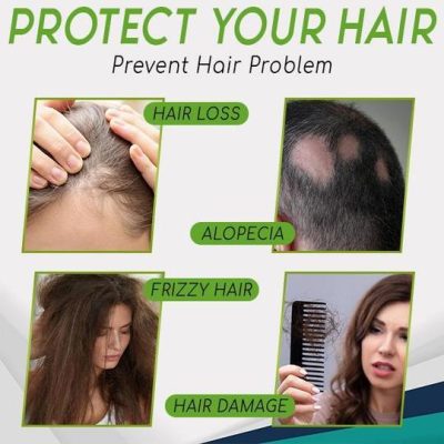 Hair-Growth Essence Spray,HerbalRevive Hair-Growth Essence Spray