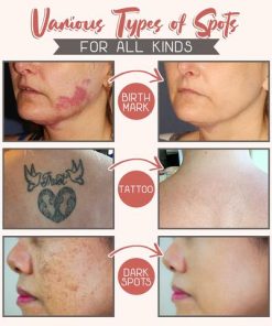 Melanin Removal Skin Balance Serum,Removal Skin Balance Serum,Skin Balance Serum,Balance Serum,Melanin Removal Skin
