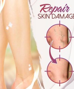 Organic Spider Pain Relief Ointment,Pain Relief Ointment,Spider Pain Relief