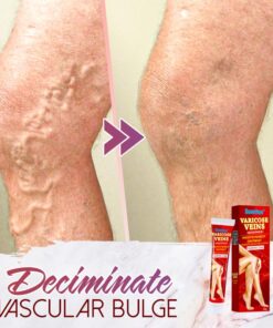 Organic Spider Pain Relief Ointment,Pain Relief Ointment,Spider Pain Relief