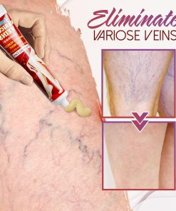 Organic Spider Pain Relief Ointment,Pain Relief Ointment,Spider Pain Relief