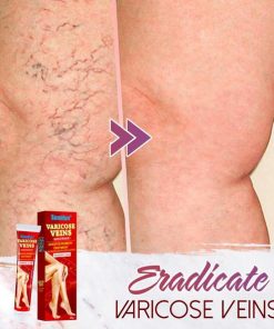 Organic Spider Pain Relief Ointment,Pain Relief Ointment,Spider Pain Relief