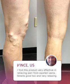 Organic Spider Pain Relief Ointment,Pain Relief Ointment,Spider Pain Relief