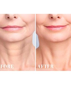 Removal Patch,Silicone Transparent Removal Patch