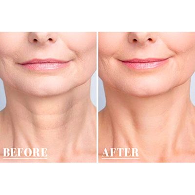 Removal Patch,Silicone Transparent Removal Patch