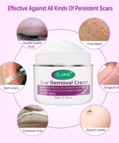 Scar Removal Cream,Scar Removal,Intensive Scar Removal Cream,Intensive Scar Removal