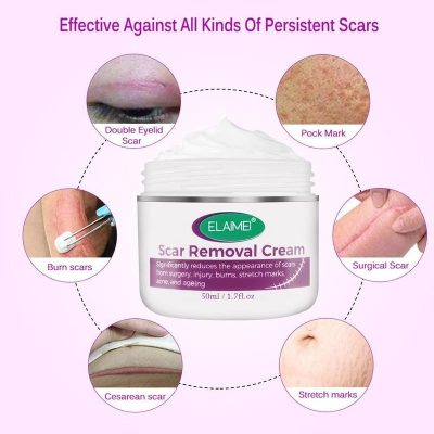 Scar Removal Cream,Scar Removal,Intensive Scar Removal Cream,Intensive Scar Removal