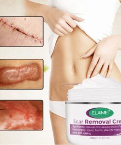 Scar Removal Cream,Scar Removal,Intensive Scar Removal Cream,Intensive Scar Removal