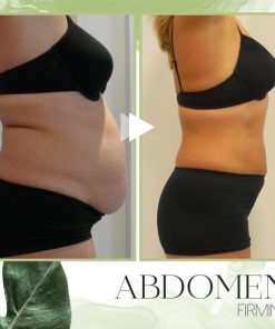 TrimDown Herbal Slimming Patch,Slimming Patch,Herbal Slimming Patch,TrimDown