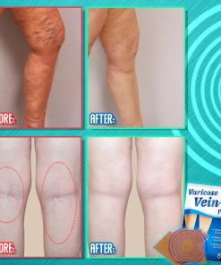 VaricoseCare Healing ReliefPatch