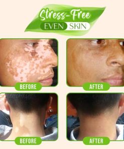 White Tag,Skin Color,Tag Skin,White Tag Skin Color Changing Serum