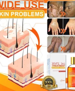 Essential Serum,White Tag,White Tag Treatment Essential Serum