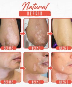 White Tag,Body Spray,White Tag Treatment Moisturizes Body Spray