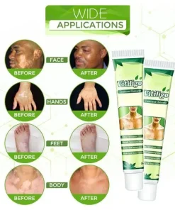 White Tag Treatment Moisturizing Cream,White Tag Treatment,Moisturizing Cream