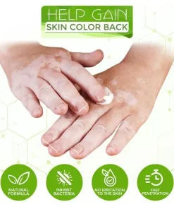 White Tag Treatment Moisturizing Cream,White Tag Treatment,Moisturizing Cream