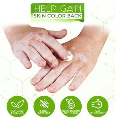 White Tag Treatment Moisturizing Cream,White Tag Treatment,Moisturizing Cream