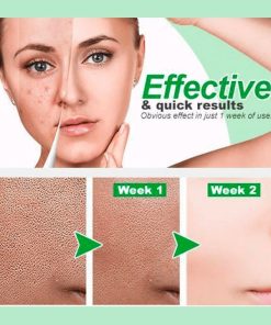 2021 New Instant Perfection Wrinkles Essence