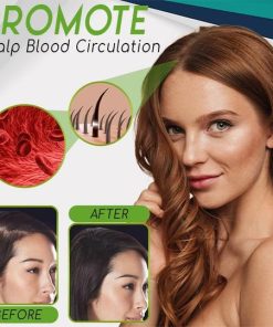 Hair Growth Essence Spray,Essence Spray,Hair Growth Essence