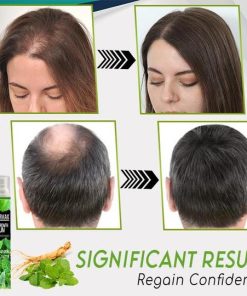 Hair Growth Essence Spray,Essence Spray,Hair Growth Essence